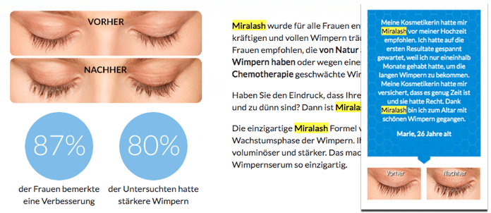 miralash vorher nachher bilder